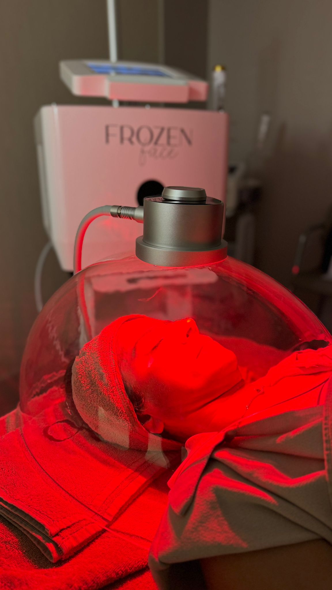 Çanakkale Frozen Face iğnesiz mezoterapi uygulaması