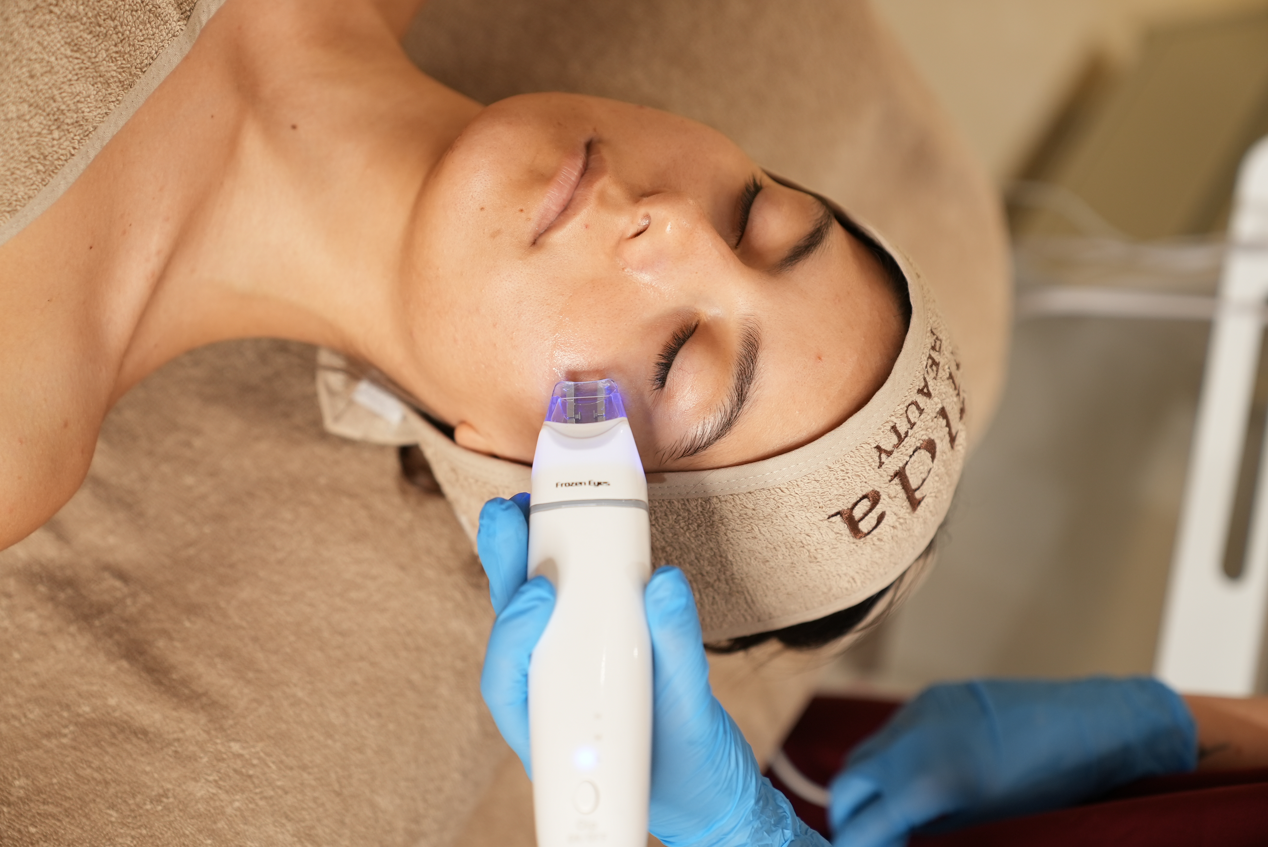 Frozen Eyes göz çevresi bakımı Çanakkale